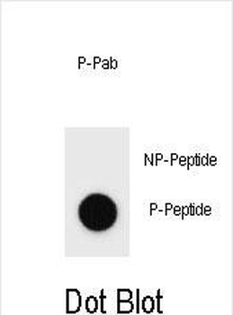 Phospho-KIT(Y900) Antibody