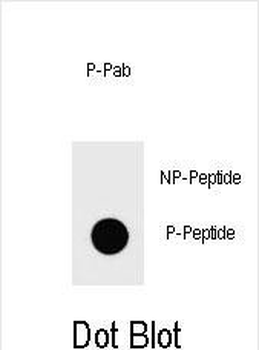 Phospho-IKKB(S672) Antibody