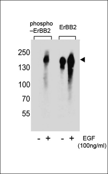 Phospho-ERBB2(Y1005) Antibody