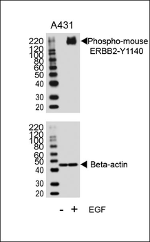 Phospho-M ERBB2(Y1140) Antibody