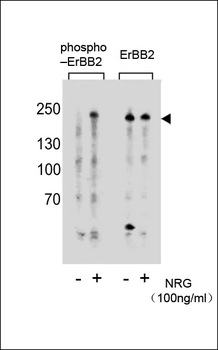 Phospho-ERBB2(Y877) Antibody