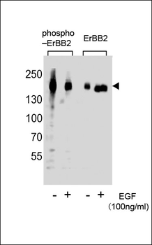 Phospho-ERBB2(Y1127) Antibody