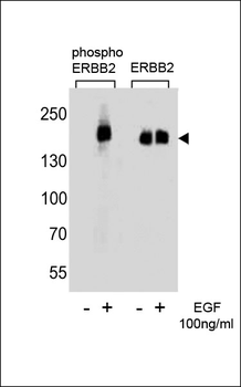 Phospho-ERBB2(Y1127) Antibody