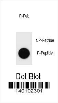 Phospho-ERBB2(S1107) Antibody