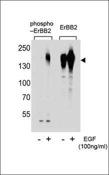 Phospho-ERBB2(S1107) Antibody
