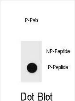 Phospho-BAD(Y76) Antibody