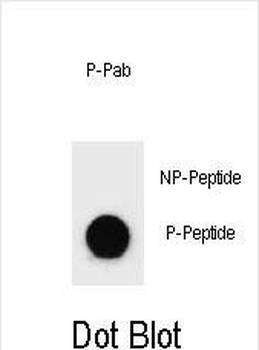 Phospho-BAD(Y110) Antibody
