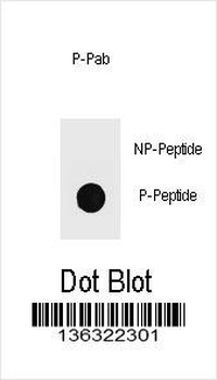 Phospho-TOPBP1(S1138) Antibody