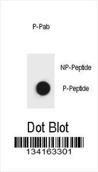 Phospho-Belcin 1 Antibody