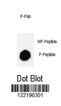 Phospho-JMJD2B(S566) Antibody