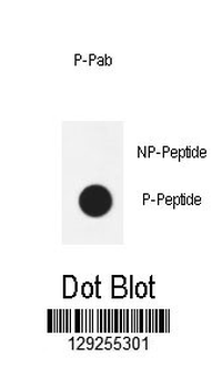 Phospho-AKT1(T450) Antibody