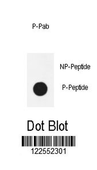 Phospho-NF kappa B(S536) Antibody