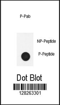 Phospho-Nephrin(Y1210)) Antibody