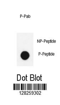 Phospho-LIMK1(Thr508)) Antibody