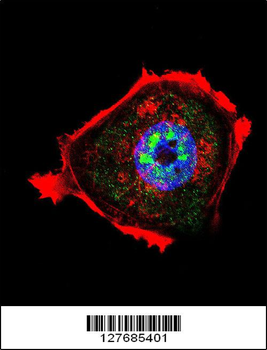 Phospho-AKT1(Thr308)) Antibody