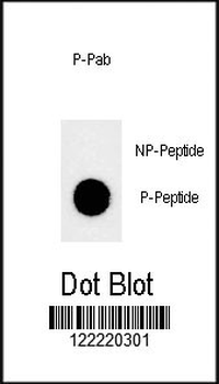 Phospho-JMJD1B(S291) Antibody