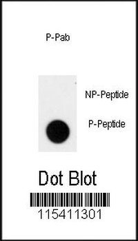 Phospho-ACK1(Y826) Antibody