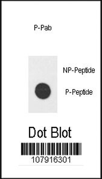 Phospho-E2F1(H357) Antibody