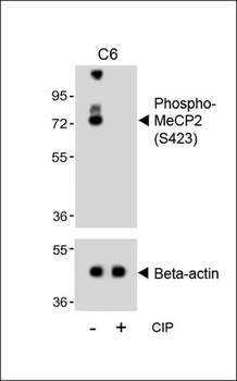 Phospho-MeCP2(S423) Antibody