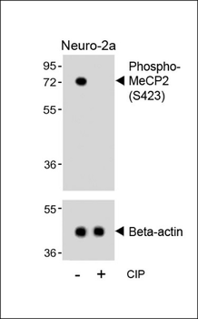Phospho-MeCP2(S423) Antibody