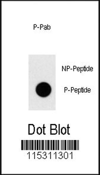 Phospho-TAL1(T90) Antibody