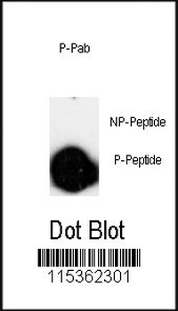 Phospho-LINGO-1(LRRN6A)(S596) Antibody