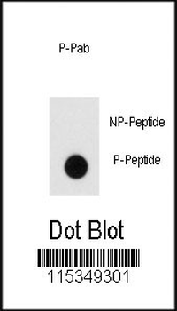 Phospho-Endophilin(Y80) Antibody
