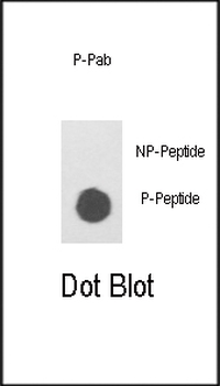 Phospho-ILK(S343) Antibody