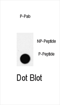 Phospho-PDX1(T11) Antibody