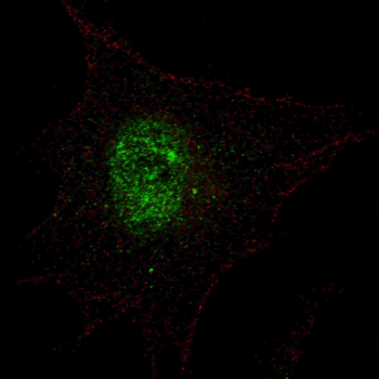 Phospho-PDX1(T11) Antibody