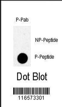 Phospho-TBK(S172) Antibody