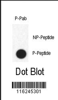 Phospho-FABP4(Y20) Antibody