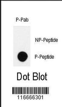 Phospho-HIPK2(Y361) Antibody