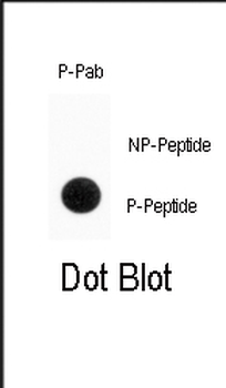 Phospho-ENT1(Slc29a1)(S254) Antibody