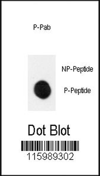 Phospho-MEK1(S222) Antibody