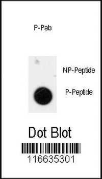 Phospho-ANTXR1(Y425) Antibody