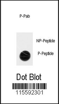 Phospho-ACK1(Y518) Antibody