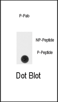 Phospho-SPRY4(Y75) Antibody