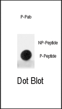 Phospho-MDM2(S395) Antibody