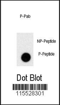 Phospho-PRL(S163) Antibody