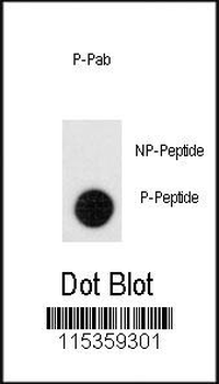 Phospho-Leo1(S551) Antibody