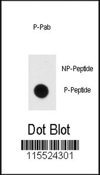 Phospho-MBP(Y203) Antibody