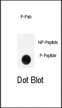 Phospho-GIT1(Y554) Antibody