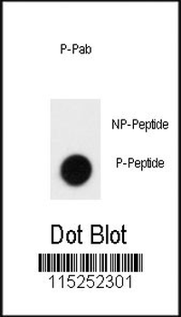 Phospho-SLAMF1(Y281) Antibody