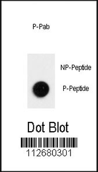 Phospho-LC3B(T12) Antibody
