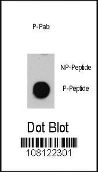 Phospho-ATM(S1981) Antibody
