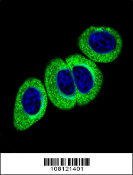 Phospho-ATM(S1981) Antibody