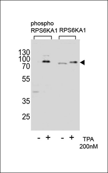 Phospho-RPS6KA1(T359) Antibody