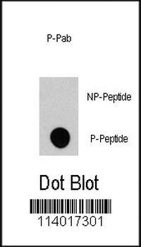 Phospho-RASGRF1(S929) Antibody