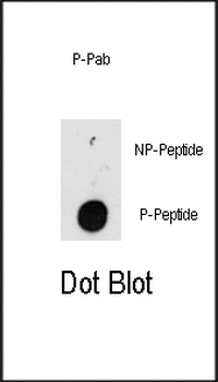 Phospho-ILK(T173) Antibody